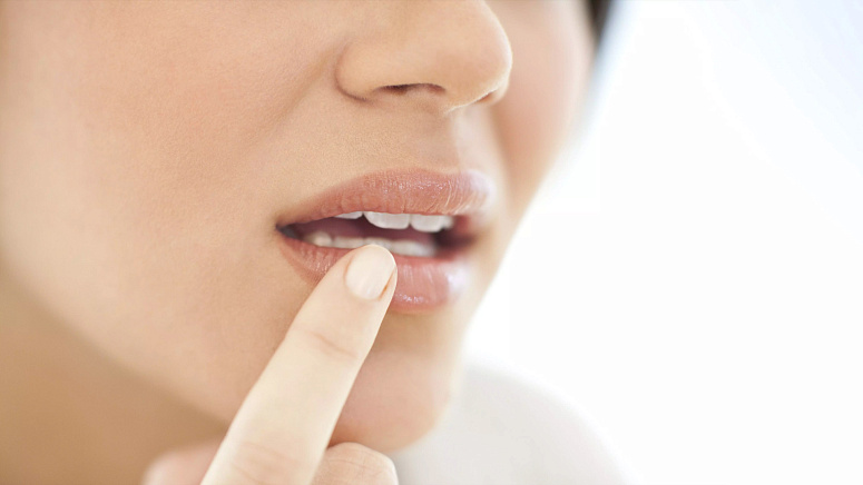 девушка с герпесом фото